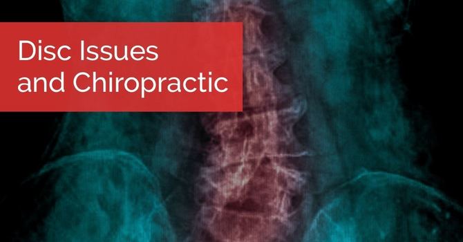 Disc Issues and Chiropractic image